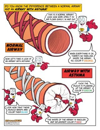 What is Asthma - Pathophysiology of Asthma For Kids