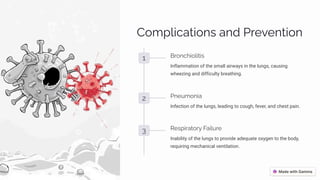 C¾³á«•caø•¾µì aµj Päppµø•¾µ
1 Bä¾µc•¾«•ø•ì
Inflammation of the small airways in the lungs, causing
wheezing and difficulty breathing.
2 Pµp ³¾µ•a
Infection of the lungs, leading to cough, fever, and chest pain.
3 Rpìá•äaø¾ä Fa•« äp
Inability of the lungs to provide adequate oxygen to the body,
requiring mechanical ventilation.
 