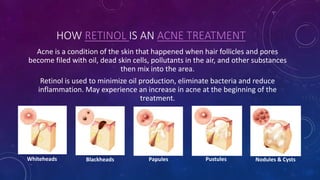 HOW RETINOL IS AN ACNE TREATMENT
Acne is a condition of the skin that happened when hair follicles and pores
become filed with oil, dead skin cells, pollutants in the air, and other substances
then mix into the area.
Retinol is used to minimize oil production, eliminate bacteria and reduce
inflammation. May experience an increase in acne at the beginning of the
treatment.
Whiteheads PustulesPapules Nodules & CystsBlackheads
 