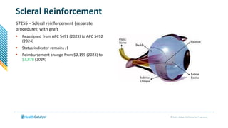 © Health Catalyst. Confidential and Proprietary.
Scleral Reinforcement
67255 – Scleral reinforcement (separate
procedure); with graft
 Reassigned from APC 5491 (2023) to APC 5492
(2024)
 Status indicator remains J1
 Reimbursement change from $2,159 (2023) to
$3,878 (2024)
 