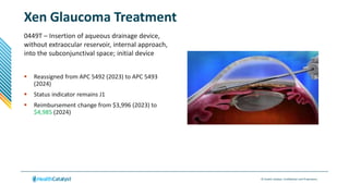 © Health Catalyst. Confidential and Proprietary.
Xen Glaucoma Treatment
0449T – Insertion of aqueous drainage device,
without extraocular reservoir, internal approach,
into the subconjunctival space; initial device
 Reassigned from APC 5492 (2023) to APC 5493
(2024)
 Status indicator remains J1
 Reimbursement change from $3,996 (2023) to
$4,985 (2024)
 