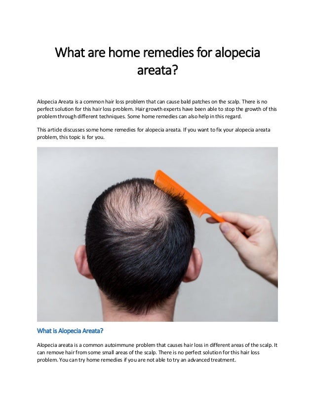 What Are Home Remedies For Alopecia Areata