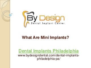 What Are Mini Implants?
Dental Implants Philadelphia
www.bydesigndental.com/dental-implants-
philadelphia-pa/
 