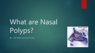 What are Nasal
Polyps?
BY: UR NEW LIFE DOT COM
 