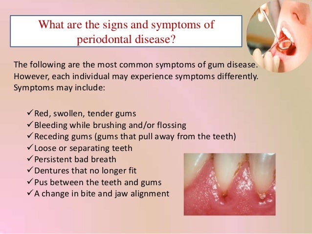 What are periodontal diseases?