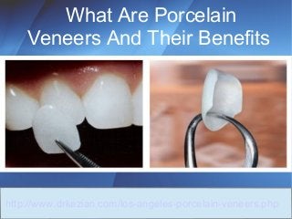 What Are Porcelain 
Veneers And Their Benefits 
http://www.drkezian.com/los-angeles-porcelain-veneers.php 
 