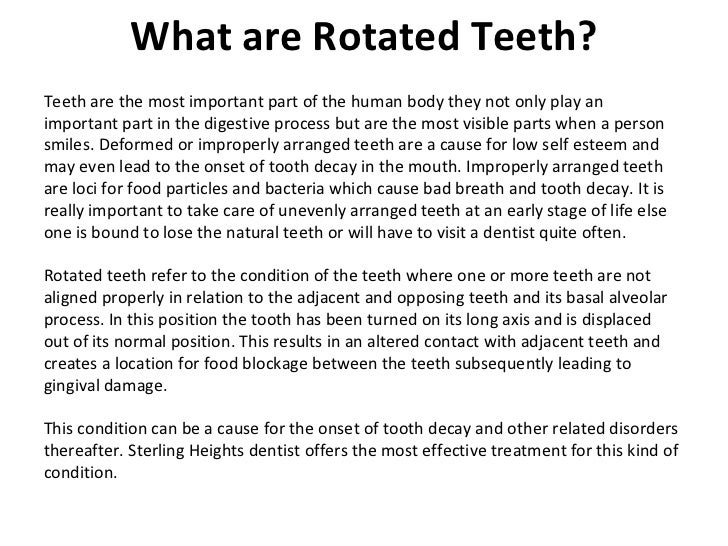 What are rotated teeth