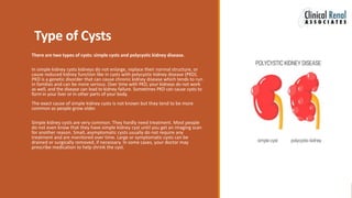 Type of Cysts
There are two types of cysts: simple cysts and polycystic kidney disease.
In simple kidney cysts kidneys do not enlarge, replace their normal structure, or
cause reduced kidney function like in cysts with polycystic kidney disease (PKD).
PKD is a genetic disorder that can cause chronic kidney disease which tends to run
in families and can be more serious. Over time with PKD, your kidneys do not work
as well, and the disease can lead to kidney failure. Sometimes PKD can cause cysts to
form in your liver or in other parts of your body.
The exact cause of simple kidney cysts is not known but they tend to be more
common as people grow older.
Simple kidney cysts are very common. They hardly need treatment. Most people
do not even know that they have simple kidney cyst until you get an imaging scan
for another reason. Small, asymptomatic cysts usually do not require any
treatment and are monitored over time. Large or symptomatic cysts can be
drained or surgically removed, if necessary. In some cases, your doctor may
prescribe medication to help shrink the cyst.
 