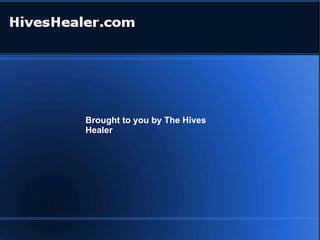 Brought to you by The Hives Healer 