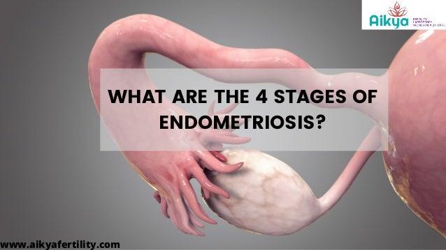 Stages Of Endometriosis