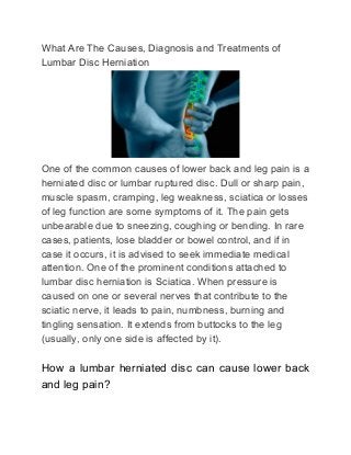 What Are The Causes, Diagnosis and Treatments of
Lumbar Disc Herniation
One of the common causes of lower back and leg pain is a
herniated disc or lumbar ruptured disc. Dull or sharp pain,
muscle spasm, cramping, leg weakness, sciatica or losses
of leg function are some symptoms of it. The pain gets
unbearable due to sneezing, coughing or bending. In rare
cases, patients, lose bladder or bowel control, and if in
case it occurs, it is advised to seek immediate medical
attention. One of the prominent conditions attached to
lumbar disc herniation is Sciatica. When pressure is
caused on one or several nerves that contribute to the
sciatic nerve, it leads to pain, numbness, burning and
tingling sensation. It extends from buttocks to the leg
(usually, only one side is affected by it).
How a lumbar herniated disc can cause lower back
and leg pain?
 
