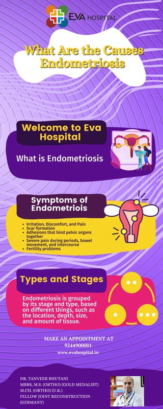 Types and Stages
Welcome to Eva
Hospital
Symptoms of
Endometriois
What is Endometriosis
Irritation, Discomfort, and Pain
Scar formation
Adhesions that bind pelvic organs
together
Severe pain during periods, bowel
movement, and intercourse
Fertility problems
Endometriosis is grouped
by its stage and type, based
on different things, such as
the location, depth, size,
and amount of tissue.
www.evahospital.in
MAKE AN APPOINTMENT AT
9244900001
DR. TANVEER BHUTANI
MBBS, M.S. (ORTHO) (GOLD MEDALIST)
M.CH. (ORTHO) (U.K.)
FELLOW JOINT RECONSTRUCTION
(GERMANY)
 