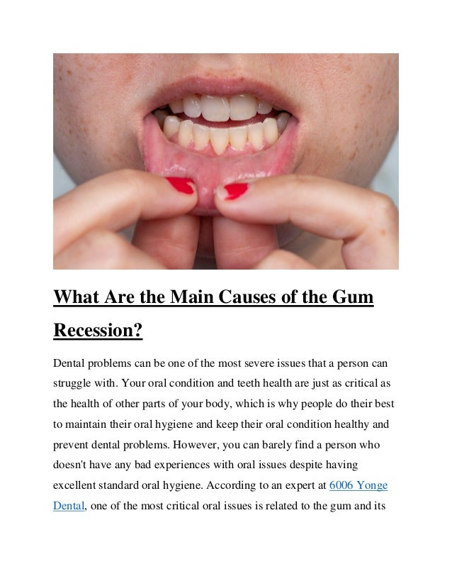 What Are the Main Causes of the Gum
Recession?
Dental problems can be one of the most severe issues that a person can
struggle with. Your oral condition and teeth health are just as critical as
the health of other parts of your body, which is why people do their best
to maintain their oral hygiene and keep their oral condition healthy and
prevent dental problems. However, you can barely find a person who
doesn't have any bad experiences with oral issues despite having
excellent standard oral hygiene. According to an expert at 6006 Yonge
Dental, one of the most critical oral issues is related to the gum and its
 
