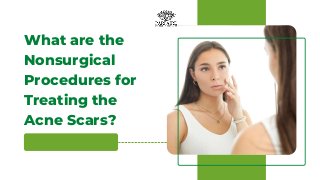 What are the
Nonsurgical
Procedures for
Treating the
Acne Scars?
 