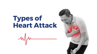 Types of
Heart Attack
 