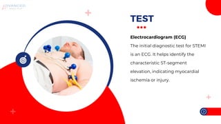 Stemi Practice Test What are the Types of Heart Attack. pptx | PPTX
