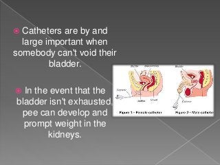  Catheters are by and
large important when
somebody can't void their
bladder.
 In the event that the
bladder isn't exhausted,
pee can develop and
prompt weight in the
kidneys.
 