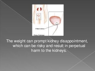 The weight can prompt kidney disappointment,
which can be risky and result in perpetual
harm to the kidneys.
 
