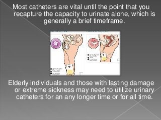 Most catheters are vital until the point that you
recapture the capacity to urinate alone, which is
generally a brief timeframe.
Elderly individuals and those with lasting damage
or extreme sickness may need to utilize urinary
catheters for an any longer time or for all time.
 