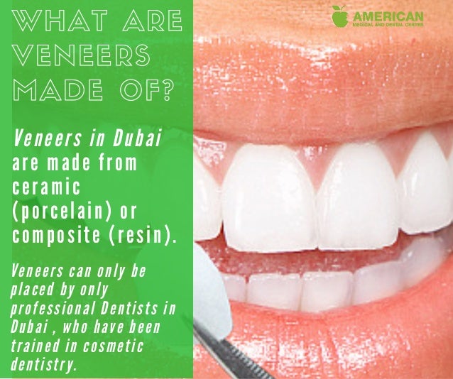 What are veneers made of