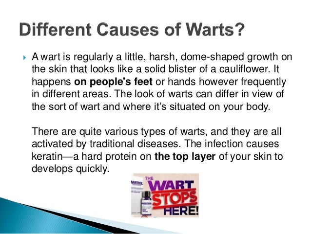 What are warts