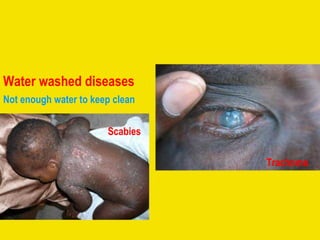 Water washed diseases Scabies Trachoma Not enough water to keep clean 