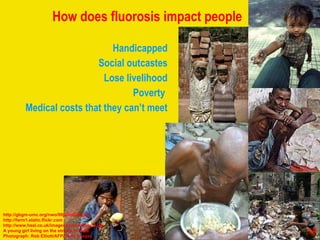 How does fluorosis impact people Handicapped Social outcastes Lose livelihood Poverty  Medical costs that they can’t meet http://gbgm-umc.org/nwo/99ja/india3.jpg http://farm1.static.flickr.com http://www.heal.co.uk/images/child-labour-3.jpg A young girl living on the streets in India. Photograph: Rob Elliott/AFP/Getty Images 