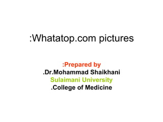 Whatatop.com pictures: Prepared by: Dr.Mohammad Shaikhani. Sulaimani University College of Medicine. 