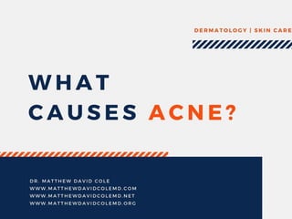 What Causes Acne by Dr. Matthew David Cole