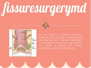 What Causes Anal Fissures