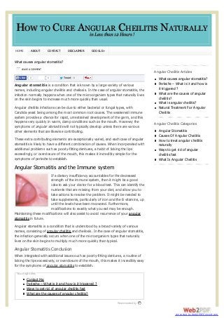 HOW TO CURE ANGULAR12CHEILITIS NATURALLY
in Less than Hours !
HOME

ABOUT

CONTACT

DISCLAIMER

GOOGLE+

What causes angular stomatitis?
LEAVE A COMMENT

Angular Cheilitis Articles
Like

0

0

Tweet

0

Angular stomatitis is a condition that is known by a large variety of various
names, including angular cheilitis and cheilosis. In the case of angular stomatitis, the
infection normally happens when one of the microorganism types that naturally lives
on the skin begins to increase much more quickly than usual.
Angular cheilitis infections can be due to either bacterial or fungal types, with
Candida yeast being among the most common root causes. The weakened immune
system provides a chance for rapid, unrestrained development of the germ, and this
happens very quickly in warm, damp conditions such as the mouth. However, the
symptoms of angular stomatitis will not typically develop unless there are various
other elements that are likewise contributing.
These extra contributing elements are exceptionally varied, and each case of angular
stomatitis is likely to have a different combination of causes. When incorporated with
additional problems such as poorly-fitting dentures, a habit of licking the lips
exceedingly, or overclosure of the mouth, this makes it incredibly simple for the
symptoms of perleche to establish.

What causes angular stomatitis?
Perleche – What is it and how is
it triggered ?
What are the causes of angular
cheilitis?
What is angular cheilitis?
Natural Treatment For Angular
Cheilitis
Angular Cheilitis Categories
Angular Stomatitis
Causes Of Angular Cheilitis
How to treat angular cheilitis
naturally
Ways to get rid of angular
cheilitis fast
What Is Angular Cheilitis

Angular Stomatitis and the Immune system
If a dietary insufficiency accountables for the decreased
strength of the immune system, then it might be a good
idea to ask your doctor for a blood test. This can identify the
nutrients that are missing from your diet, and allow you to
take actions to resolve the problem. It might be needed to
take supplements, particularly of iron and the B vitamins, up
until the levels have been recovered. Furthermore,
modifications to exactly what you eat may be enough.
Maintaining these modifications will also assist to avoid recurrence of your angular
stomatitis in future.
Angular stomatitis is a condition that is understood by a broad variety of various
names, consisting of angular cheilitis and cheilosis. In the case of angular stomatitis,
the infection generally occurs when one of the microorganism types that naturally
lives on the skin begins to multiply much more quickly than typical.

Angular Stomatitis Conclusion
When integrated with additional issues such as poorly-fitting dentures, a routine of
licking the lips excessively, or overclosure of the mouth, this makes it incredibly easy
for the symptoms of angular stomatitis to establish.
You might like:

Contact Me
Perleche – What is it and how is it triggered ?
Ways to get rid of angular cheilitis fast
What are the causes of angular cheilitis?
Recommended by

converted by Web2PDFConvert.com

 