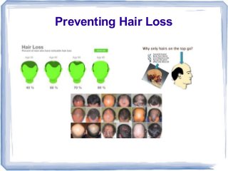 Preventing Hair Loss

 