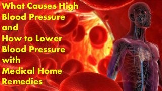 What Causes High
Blood Pressure
and
How to Lower
Blood Pressure
with
Medical Home
Remedies
 