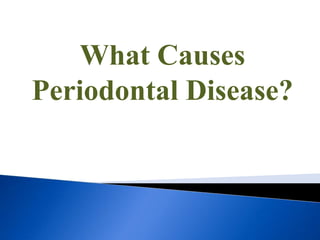 What Causes
Periodontal Disease?
 