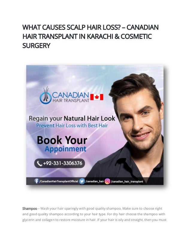 What Causes Scalp Hair Loss