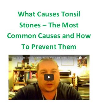 What Causes Tonsil
Stones – The Most
Common Causes and How
To Prevent Them
 