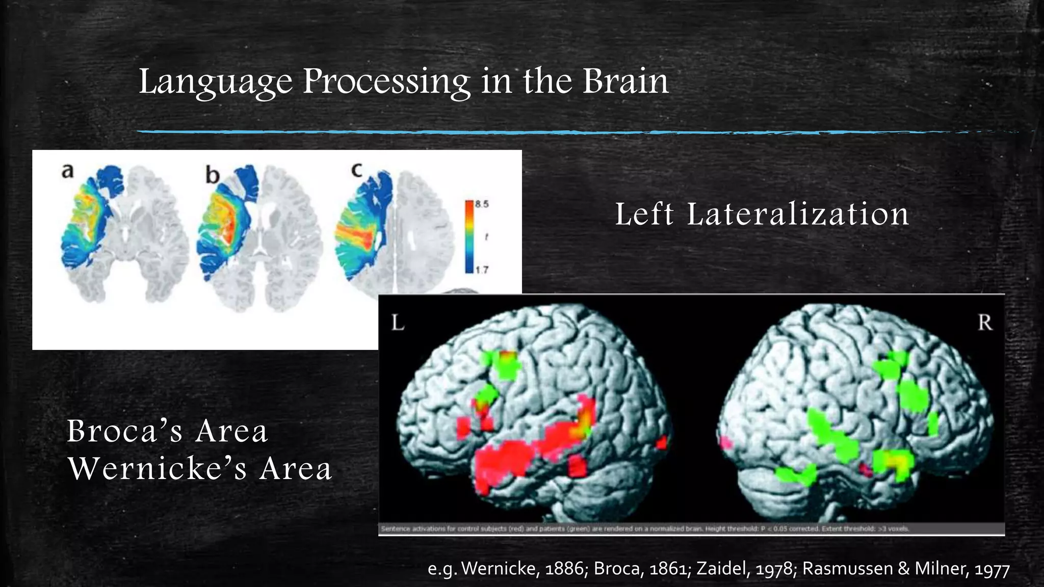Language Processing in the Brain
e.g.Wernicke, 1886; Broca, 1861; Zaidel, 1978; Rasmussen & Milner, 1977
Broca’s Area
Wernicke’s Area
Left Lateralization
 