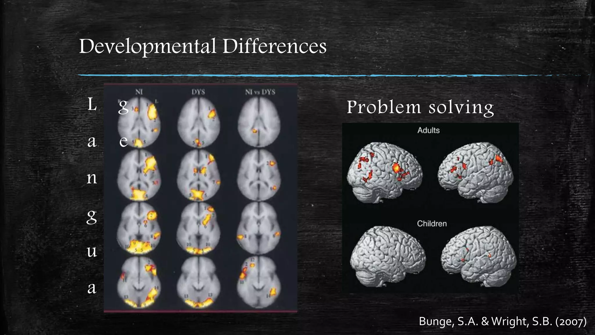 Developmental Differences
Bunge, S.A. &Wright, S.B. (2007)
Problem solvingL
a
n
g
u
a
g
e
 