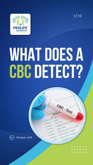 WHAT DOES A
CBCDETECT?
1 / 1 0
Swipe Left
 