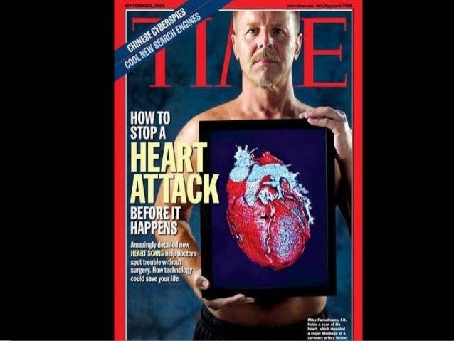 What Does Coronary Calcium Score Mean 
