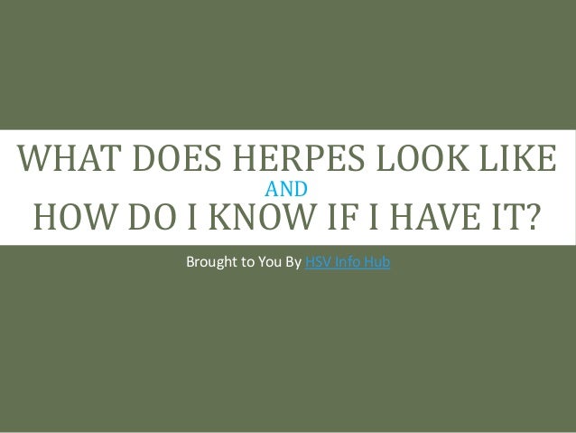 What Does Herpes Look Like And How Do I Know If I Have It