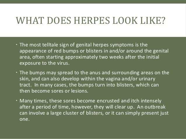 What Does Herpes Look Like And How Do I Know If I Have It What Does Herpes Look Like And How Do I Know If I Have It
