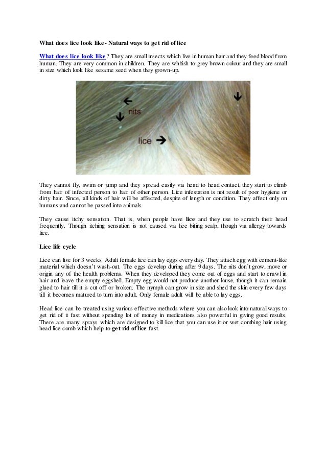What Does Lice Look Like Natural Ways To Get Rid Of It