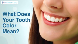 What Does
Your Tooth
Color
Mean?
 