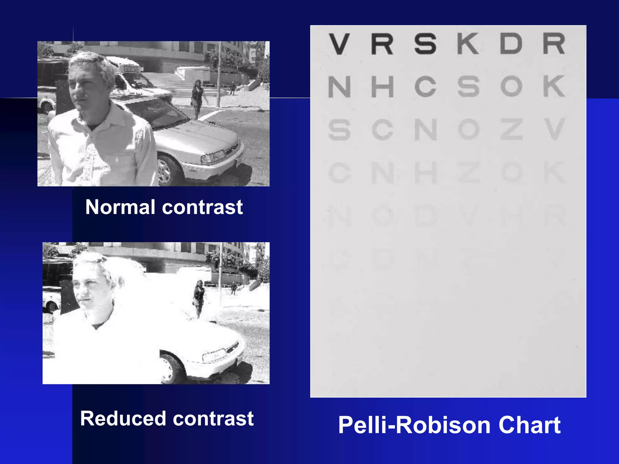 Normal contrast
Reduced contrast Pelli-Robison Chart
 