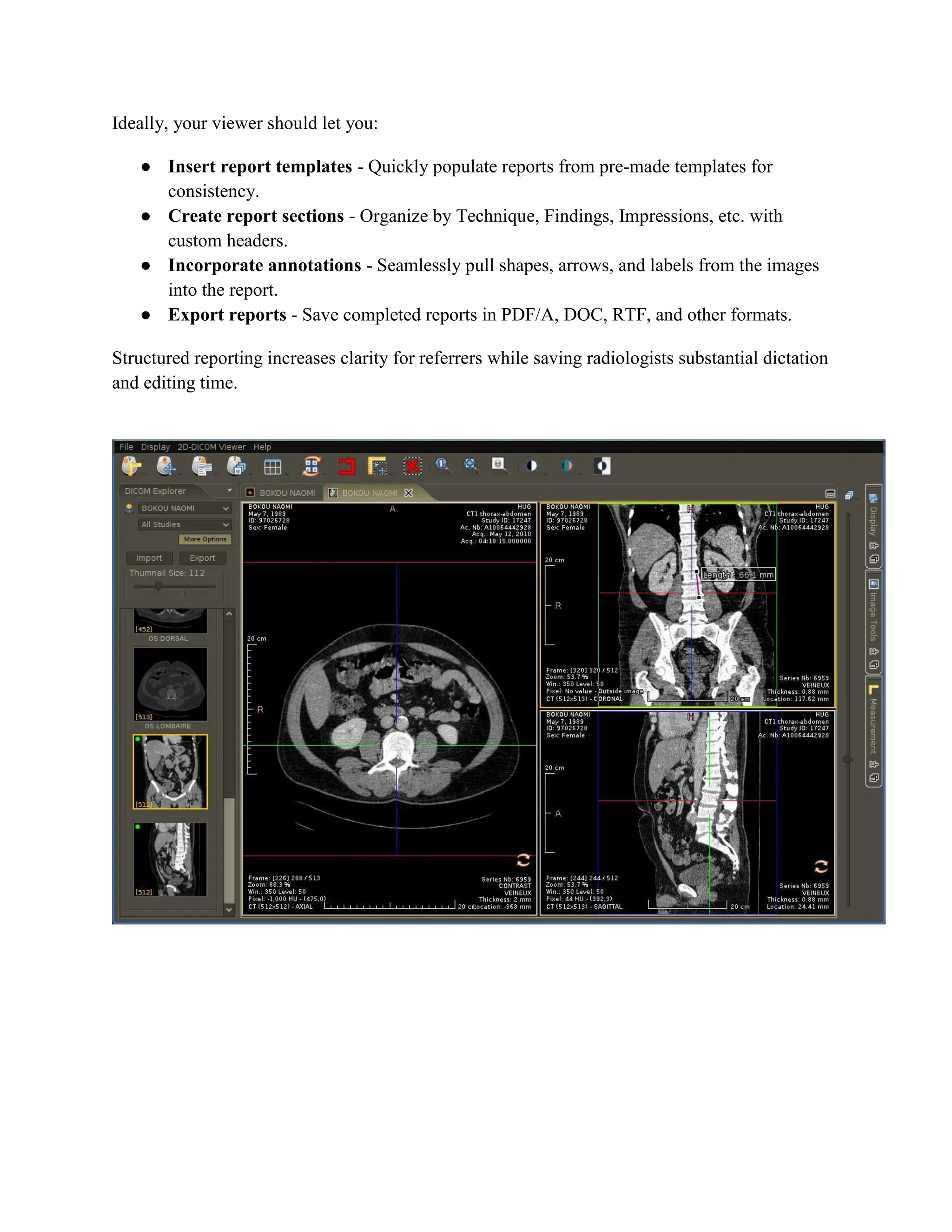 Ideally, your viewer should let you:
● Insert report templates - Quickly populate reports from pre-made templates for
consistency.
● Create report sections - Organize by Technique, Findings, Impressions, etc. with
custom headers.
● Incorporate annotations - Seamlessly pull shapes, arrows, and labels from the images
into the report.
● Export reports - Save completed reports in PDF/A, DOC, RTF, and other formats.
Structured reporting increases clarity for referrers while saving radiologists substantial dictation
and editing time.
 