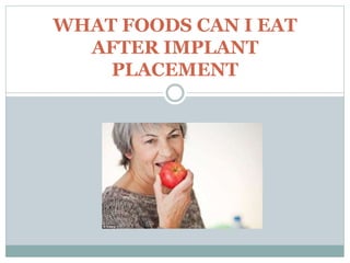 WHAT FOODS CAN I EAT
AFTER IMPLANT
PLACEMENT
 