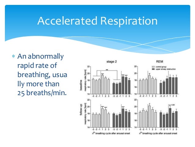 rem sleep versus deep sleep rem sleep versus deep sleep