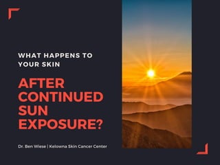 WHAT HAPPENS TO
YOUR SKIN
AFTER
CONTINUED
SUN
EXPOSURE?
Dr. Ben Wiese | Kelowna Skin Cancer Center
 