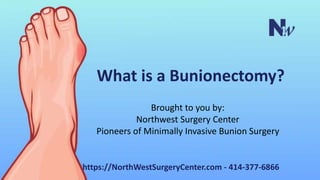 What is a Bunionectomy?
Brought to you by:
Northwest Surgery Center
Pioneers of Minimally Invasive Bunion Surgery
https://NorthWestSurgeryCenter.com - 414-377-6866
 